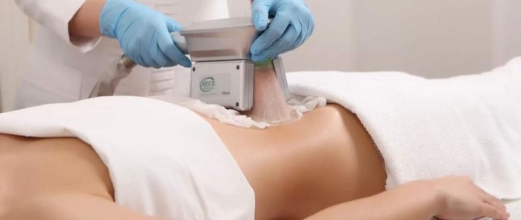 How to Lose Belly Fat cryolipolysis 1024x433