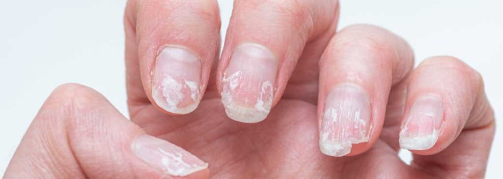 Nail growth and strengthening serum