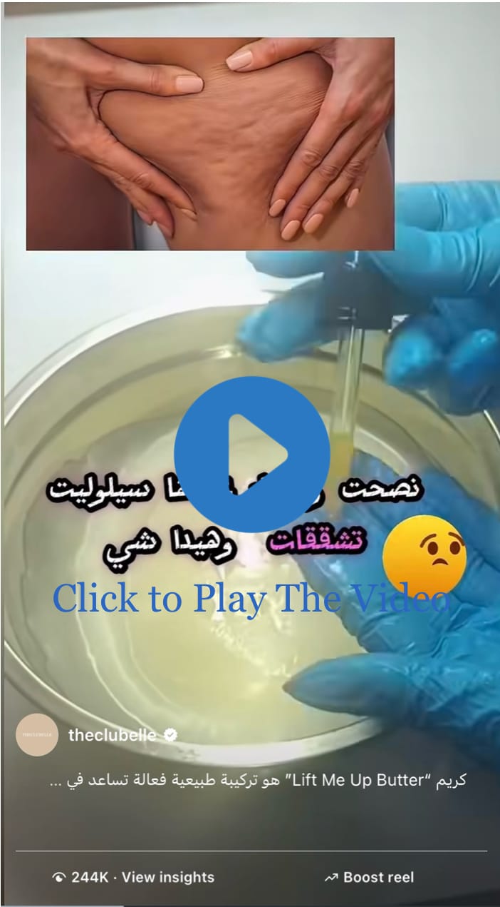 lift me up | cellulite butter